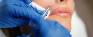 Relleno Facial y Rinomodelacion con Ácido Hialurónico